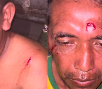 Indígenas venezuelanos são agredidos; prefeitura aciona PF para intervir na situação